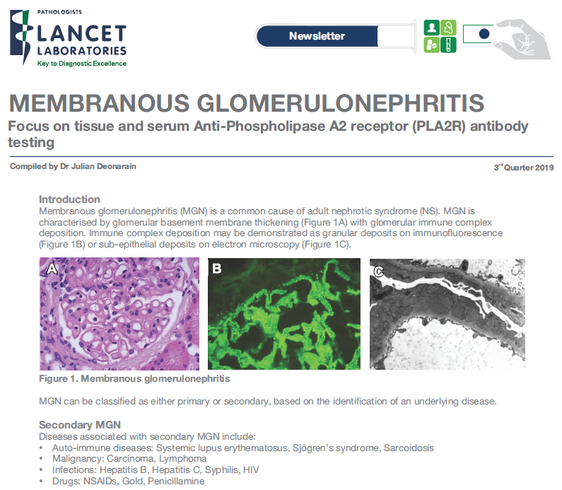 Membranous Glomerulonephritis - Lancet Laboratories