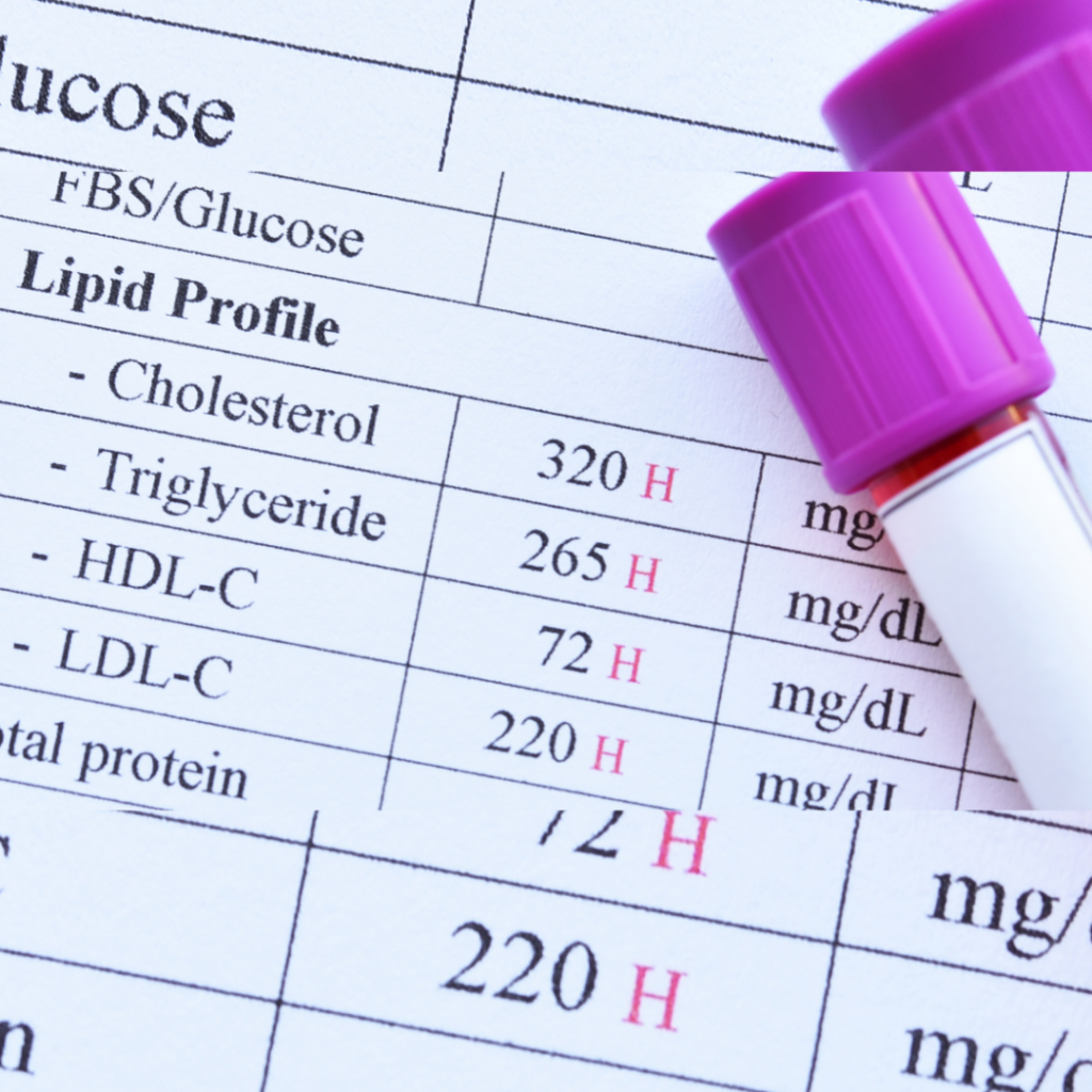 Lipid Profile